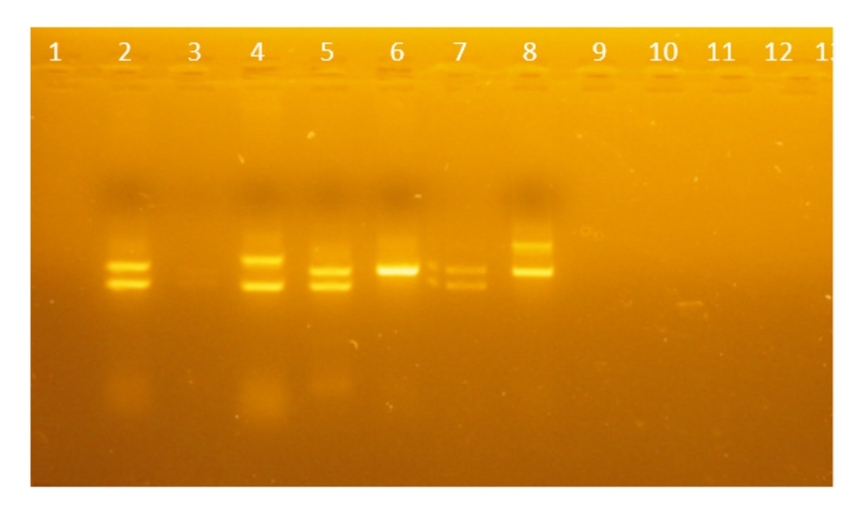 Ergebnis der Gel-Elektrophorese