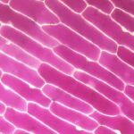 Zwiebelzelle Zwiebelzeööe